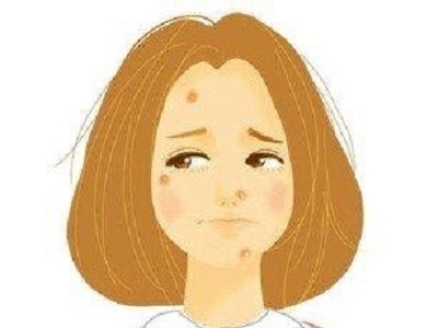 牛皮癣疾病能  治吗